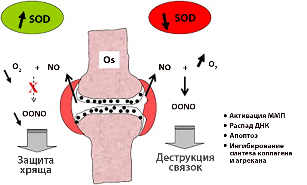Здоровье суставов